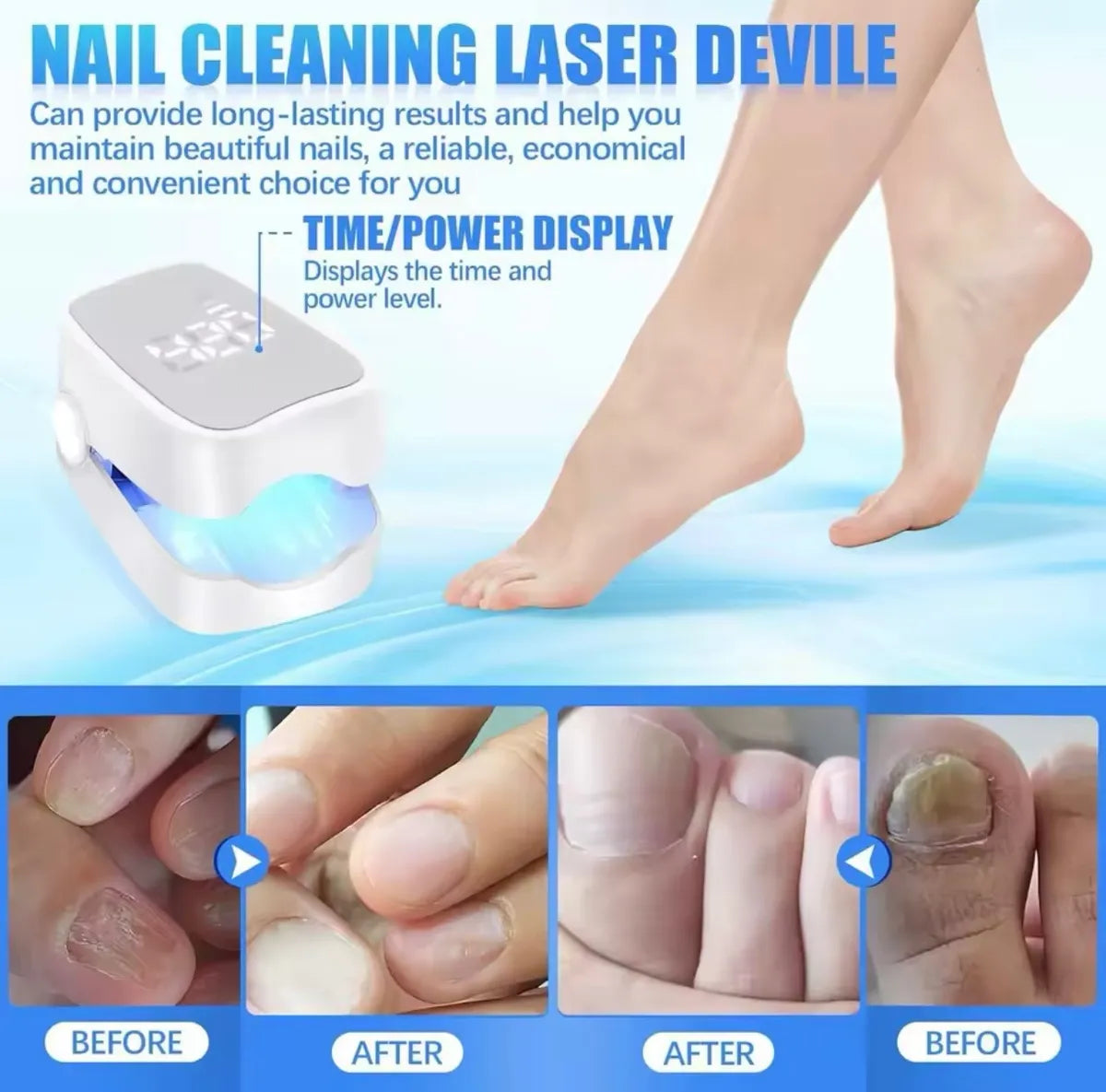 Laser para hongos