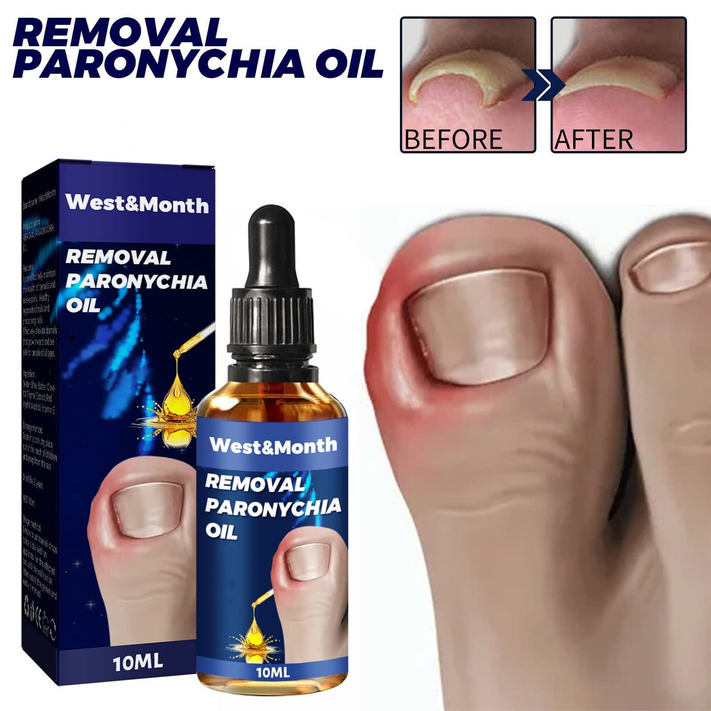 Formula Natural para Hongos