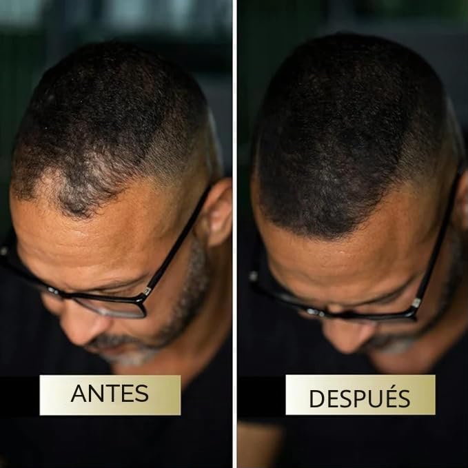 Tiveno Shampoo